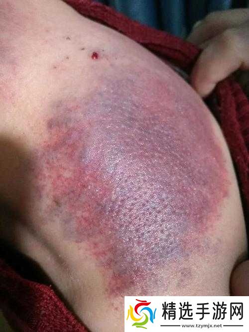 一碰就湿是属于什么体质:相关探讨