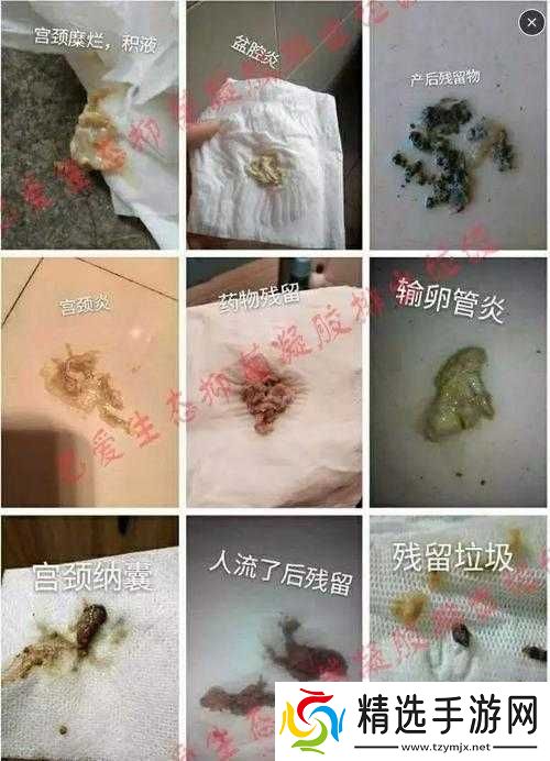 月月我这是帮你排阴毒