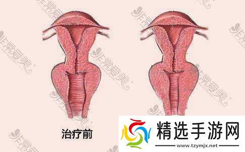 蜜桃皇后私密紧致效果究竟如何