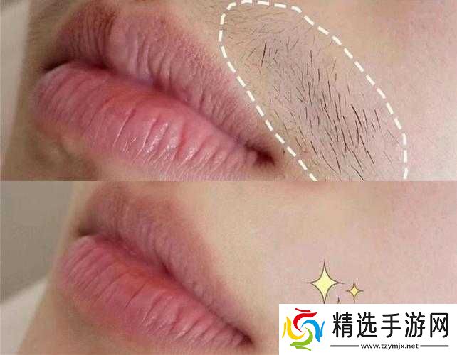 二十多岁唇毛明显到十八岁