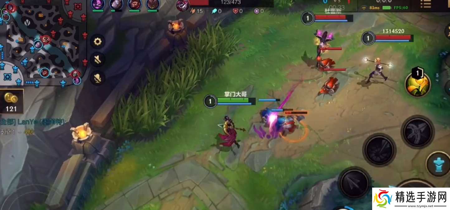 英雄联盟手游薇恩怎么玩